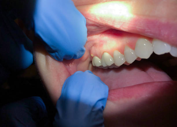 Best Knocked-Out Tooth Emergency  in Jefferson, WI