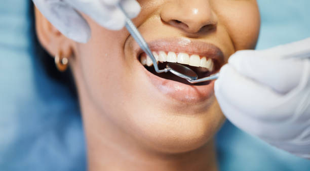 Best Teeth Whitening  in Jefferson, WI