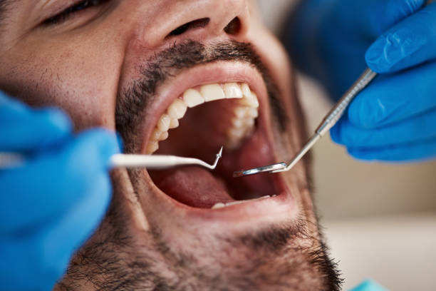 Best Tooth Infection Emergency Dentist  in Jefferson, WI